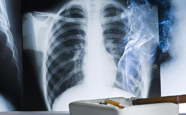 Cáncer de pulmón: un síntoma no es un diagnóstico
