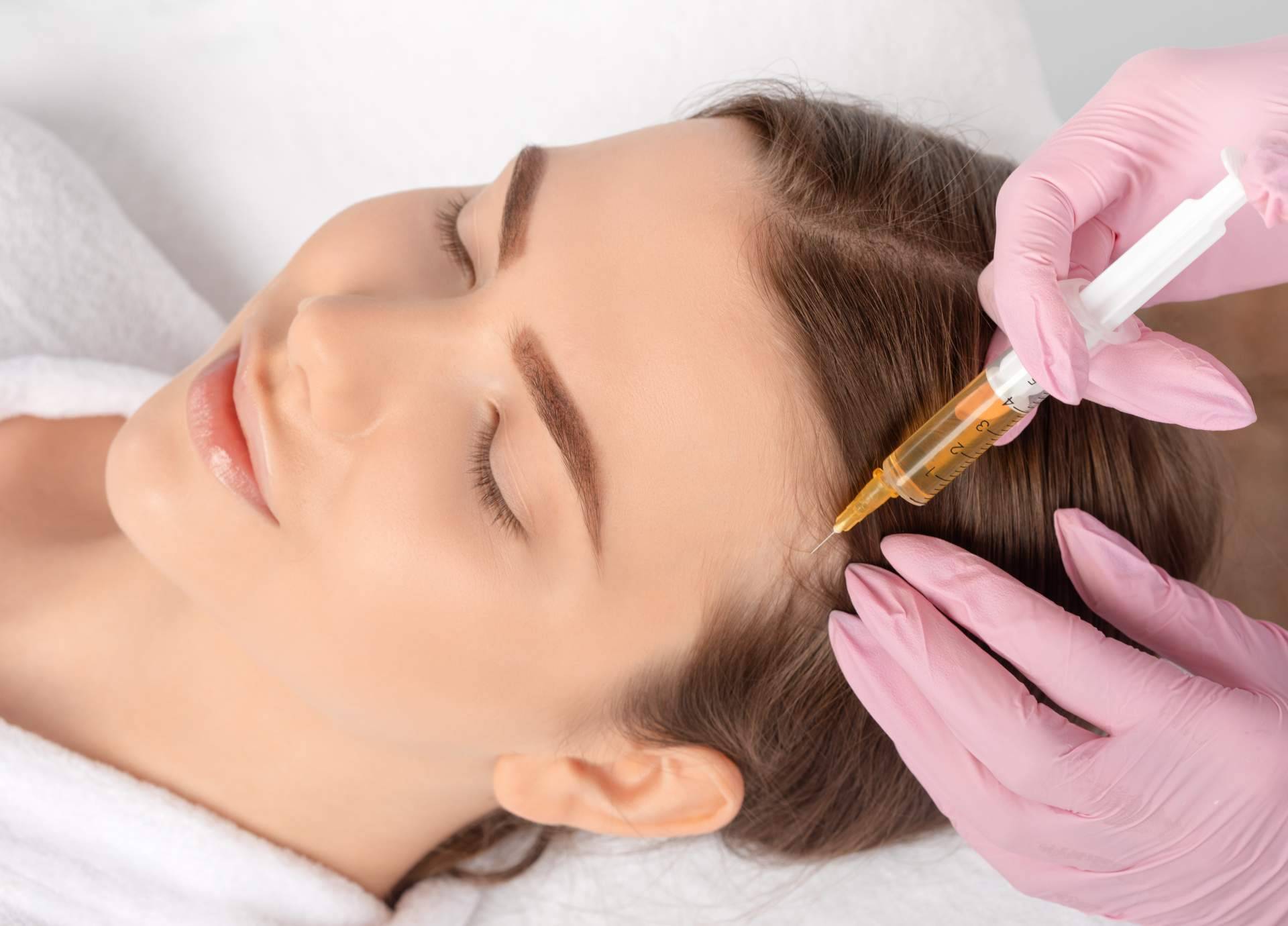 Mesoterapia capilar, vitaminas y plasma rico en plaquetas