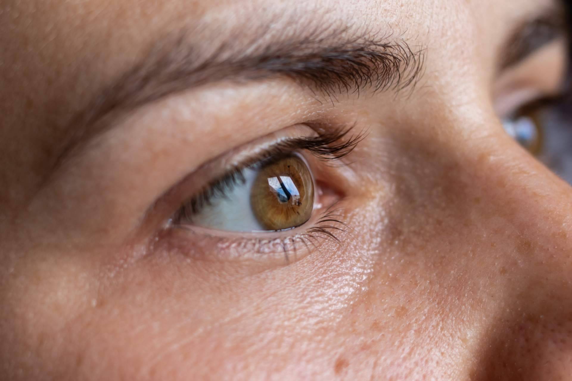 Los trasplantes de cejas con el método Zafiro de Élite Capilar