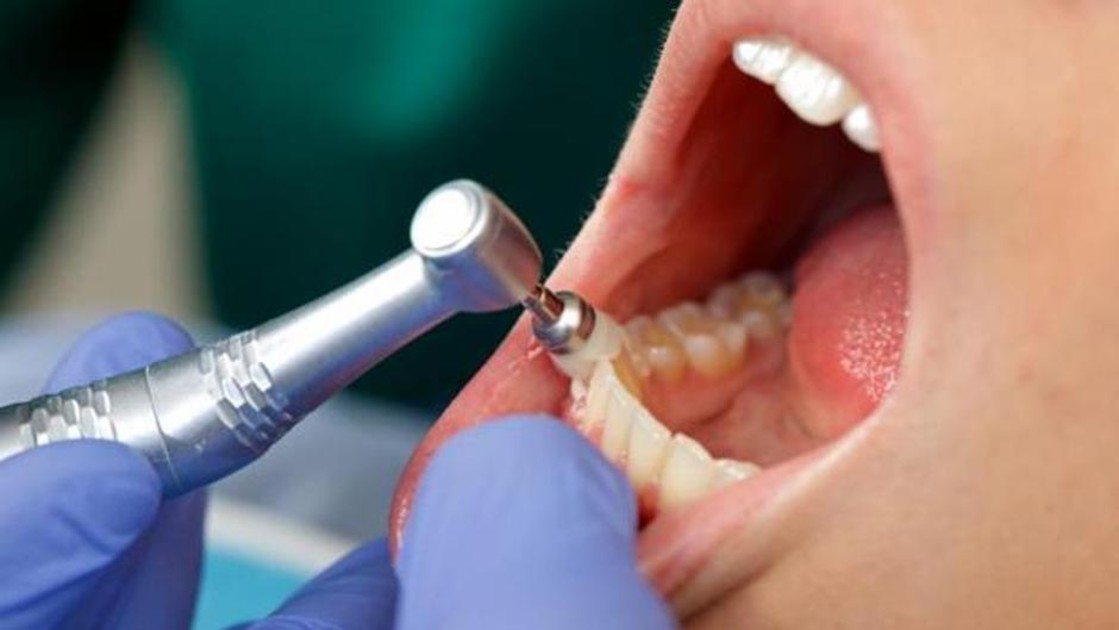 La relación que existe entre tus dientes y el Alzheimer