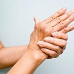 Artritis: primeros síntomas y cómo prevenirla