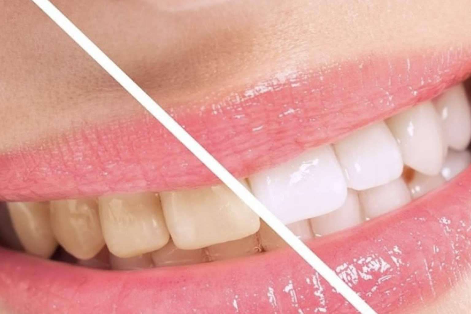 ¿Por qué es importante realizarse tratamientos dentales de la mano de expertos? DeltaDent