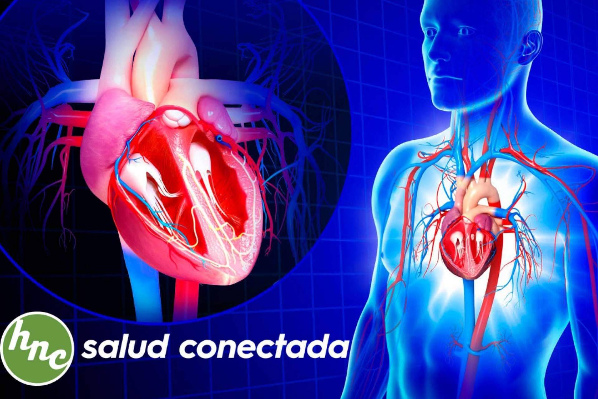 El software de cardiología de Health Net Connections