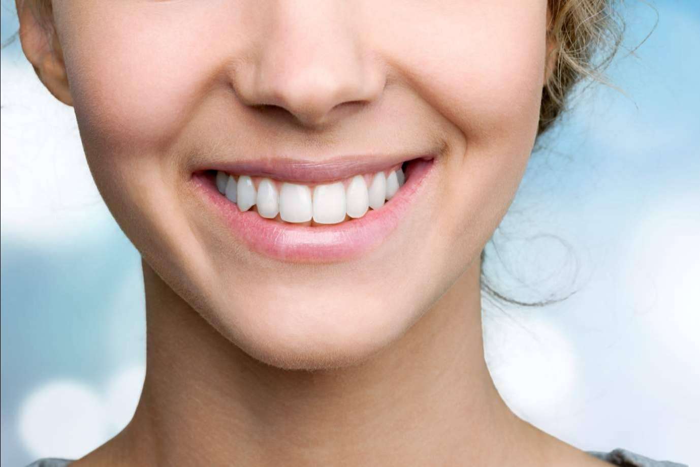 Clínicas Dental Bell, mejorar el aspecto de una sonrisa con un blanqueamiento dental