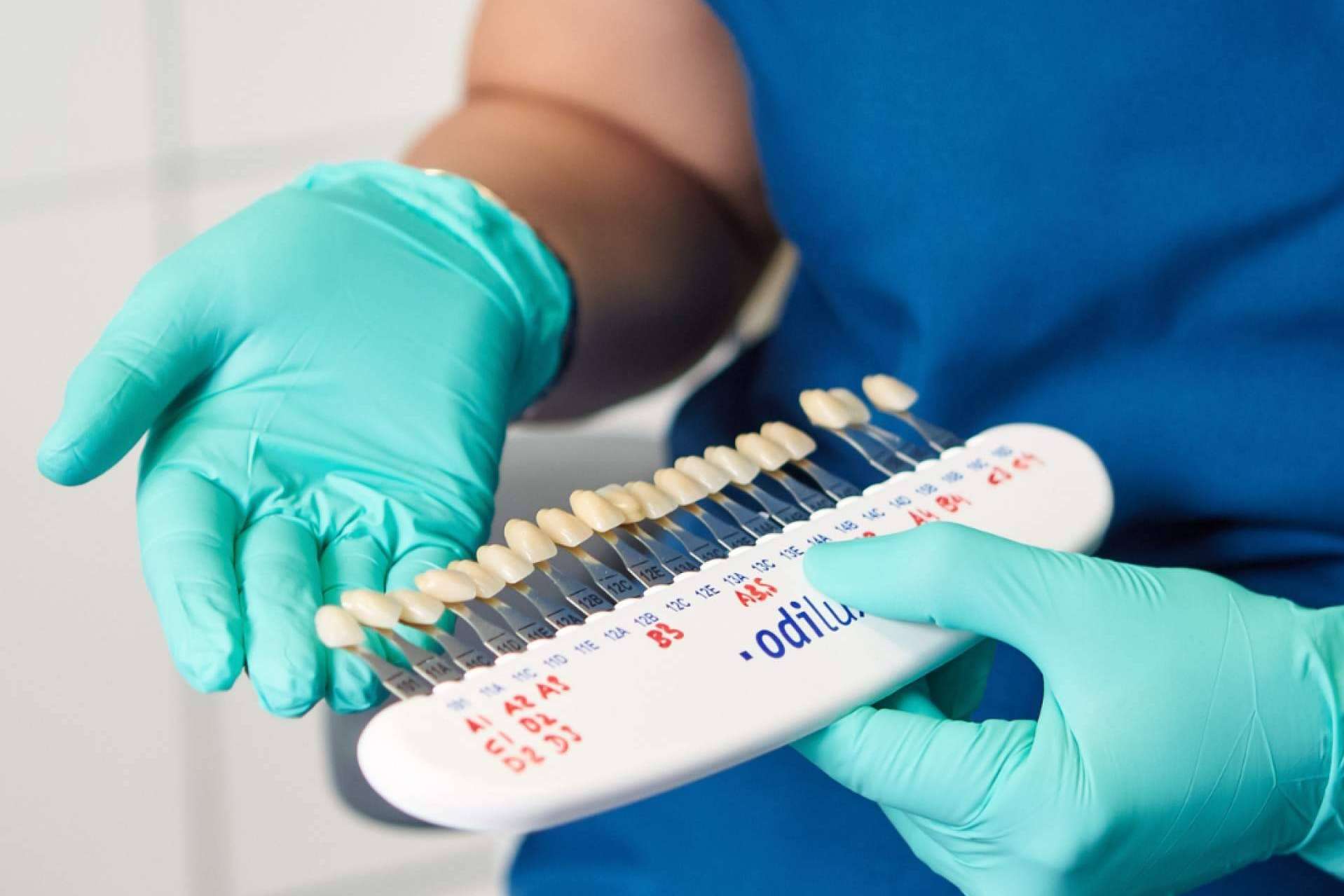 Las carillas dentales, un tratamiento estético dental muy demandado