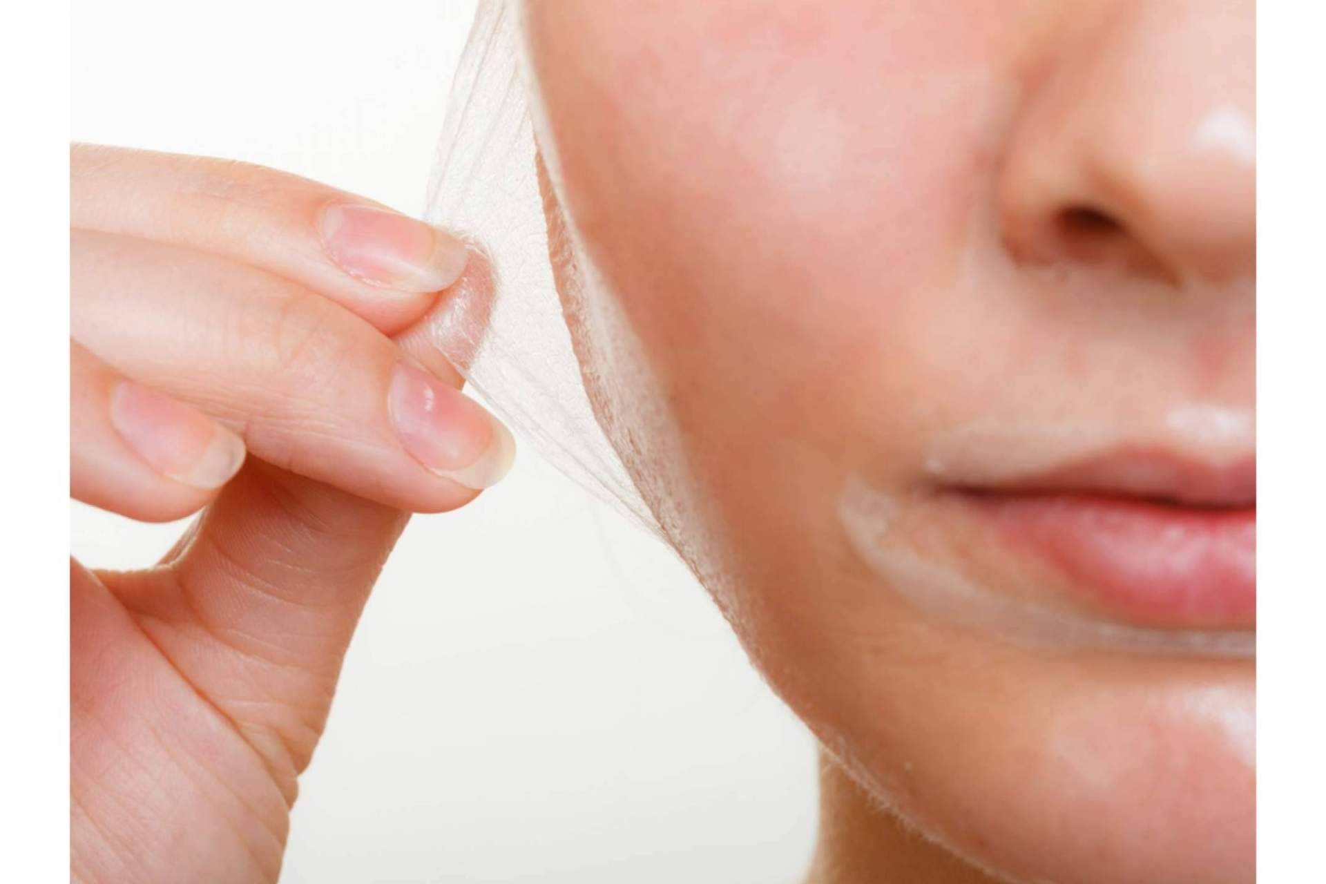 Peeling químico en diferentes partes del cuerpo, con Crina Rus Beauty Center