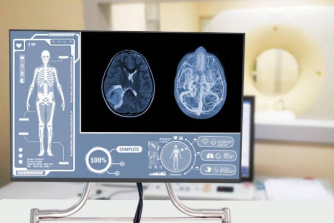 Por qué el sarcoma aparece en jóvenes