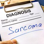 Sarcoma: síntomas tempranos del cáncer más común entre los jóvenes