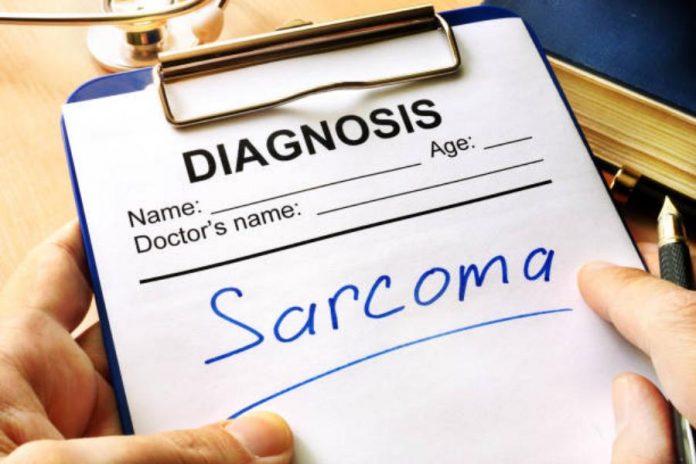Sarcoma: síntomas tempranos del cáncer más común entre los jóvenes