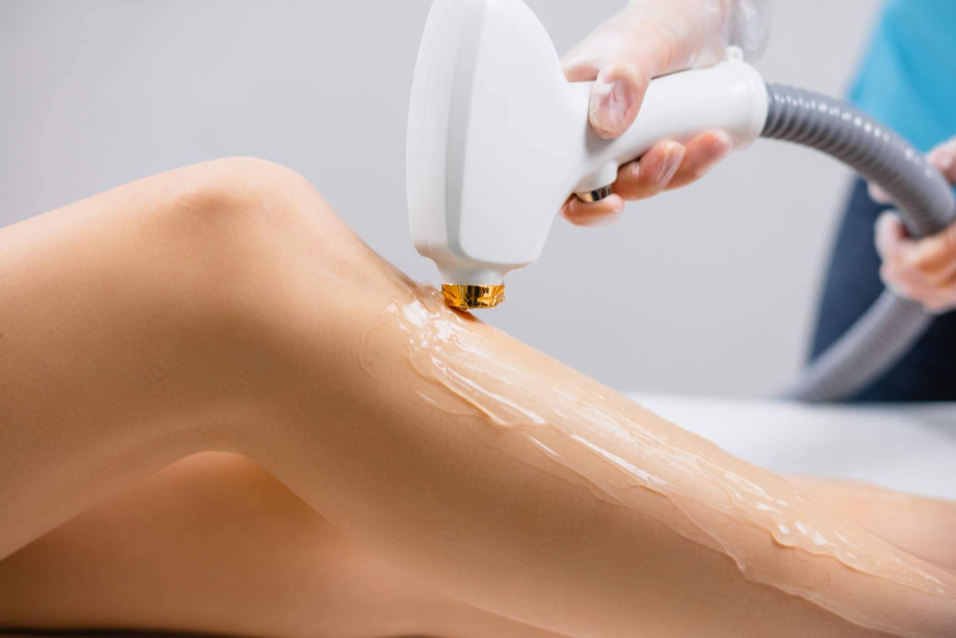 Los beneficios del láser de diodo Venus de Comercial Estética
