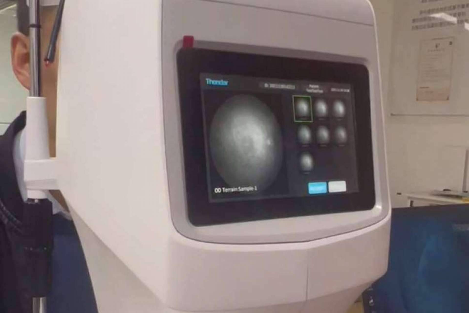 El sistema de diagnóstico multiespectral permite un mayor control de la miopía