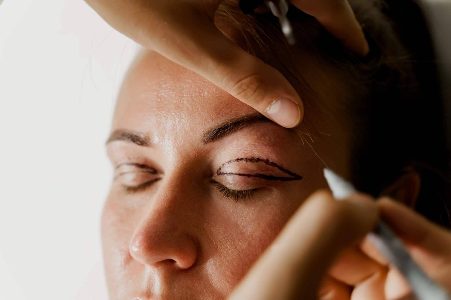 Alluring Clinic y la blefaroplastia no quirúrgica