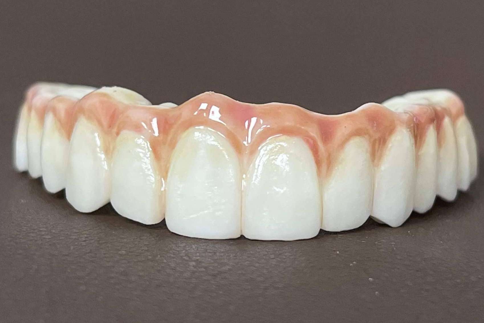 Dentinova aplica la impresión 3D para hacer posible los dientes en un día