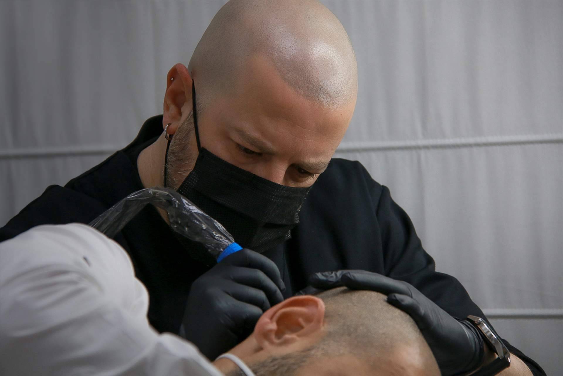 INBLAK explica los beneficios de la micropigmentación capilar que realiza