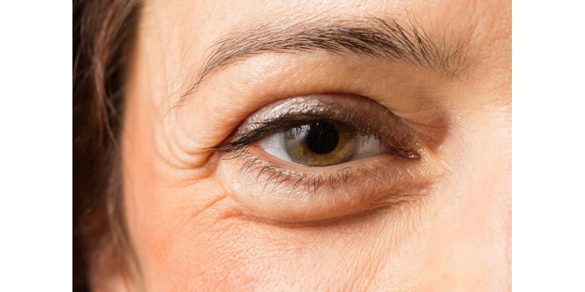 Las formas más efectivas para eliminar las arrugas sin maquillarte