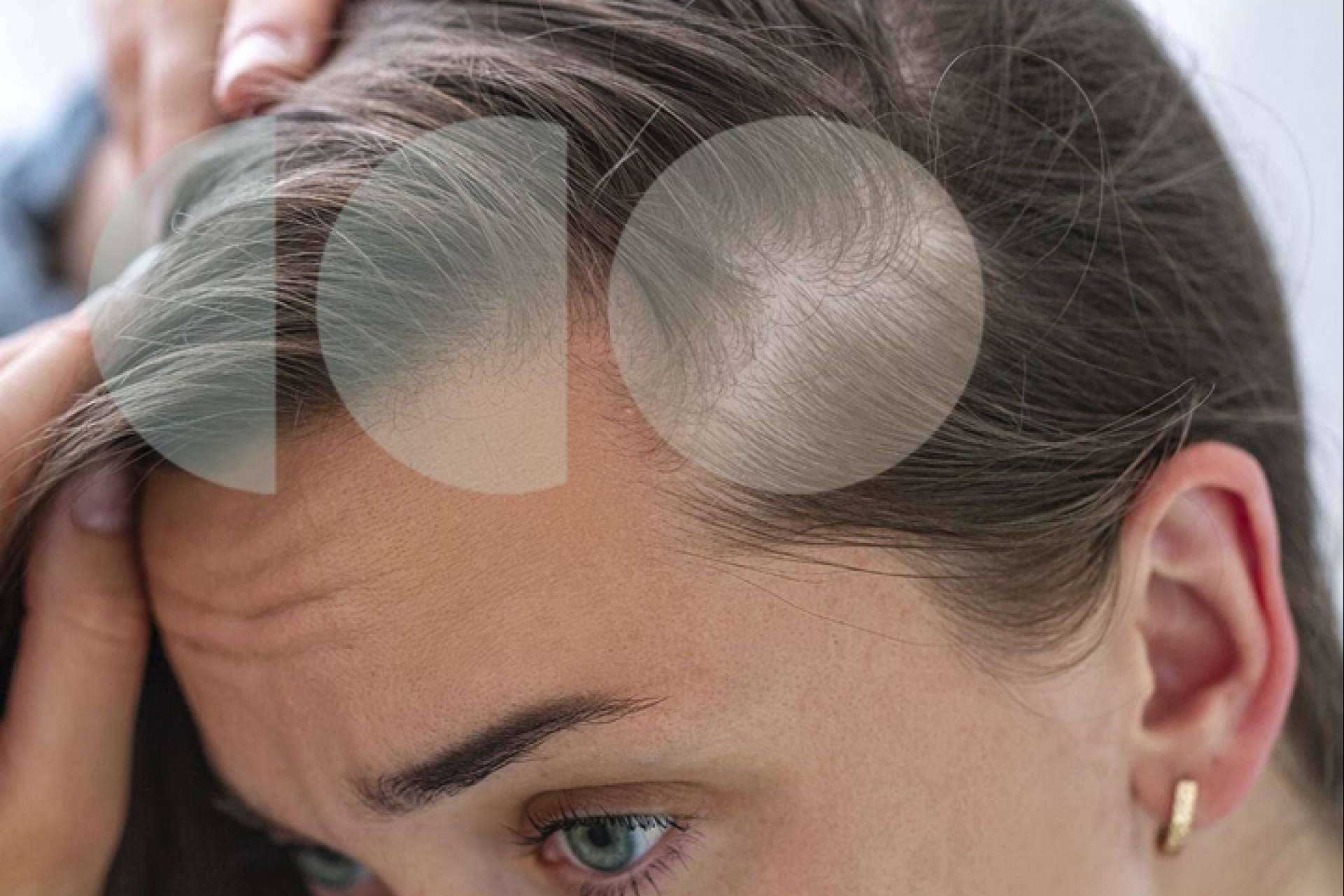 La caída de cabello estacional viene más fuerte este año