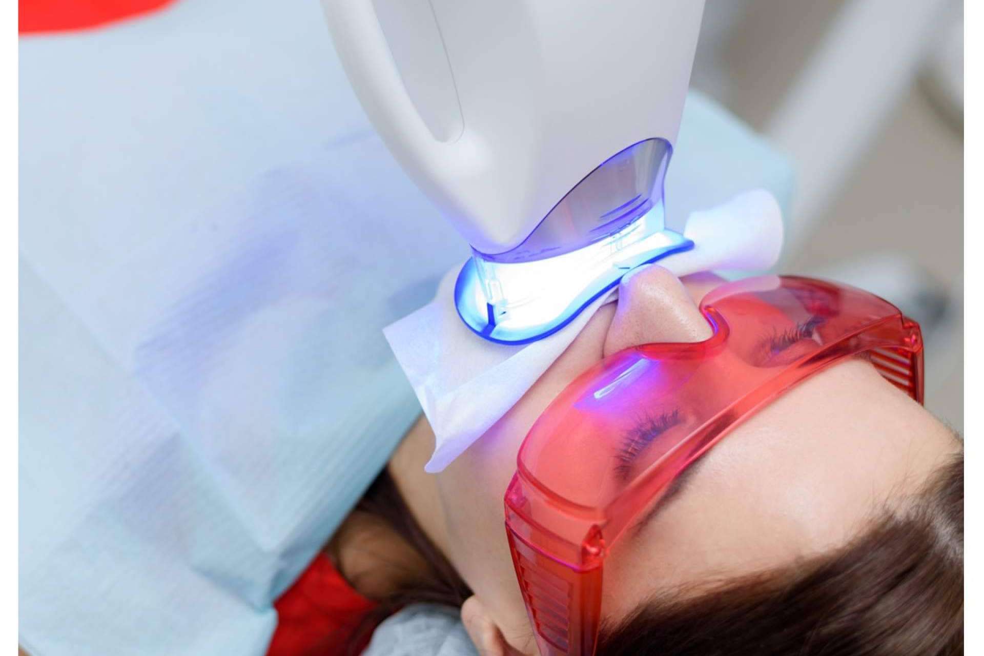 ¿Cómo se lleva a cabo un blanqueamiento dental?, por Clínica Dental Delgado