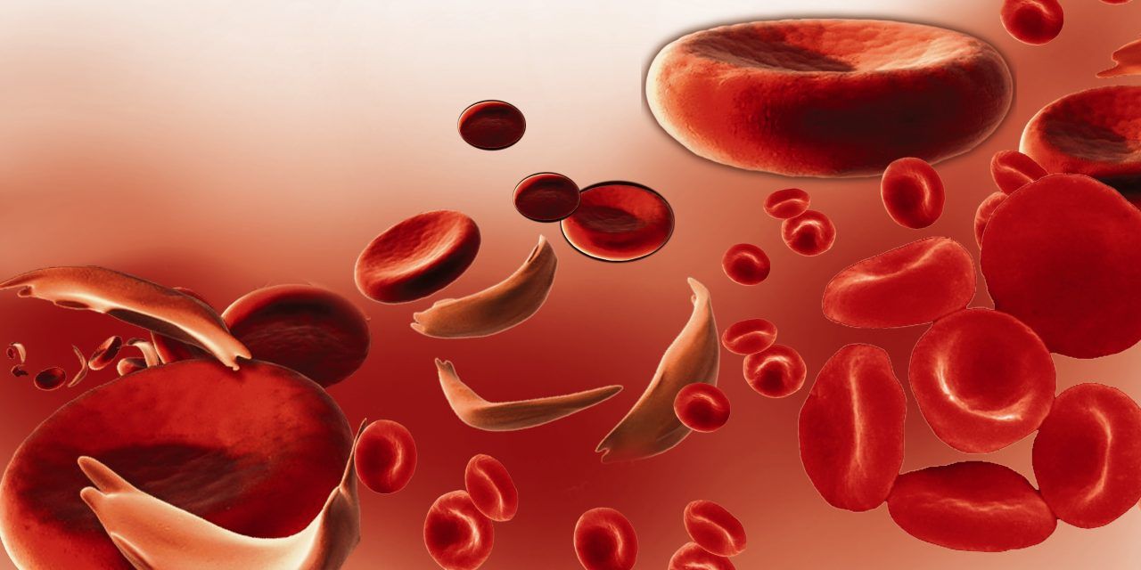 anemia