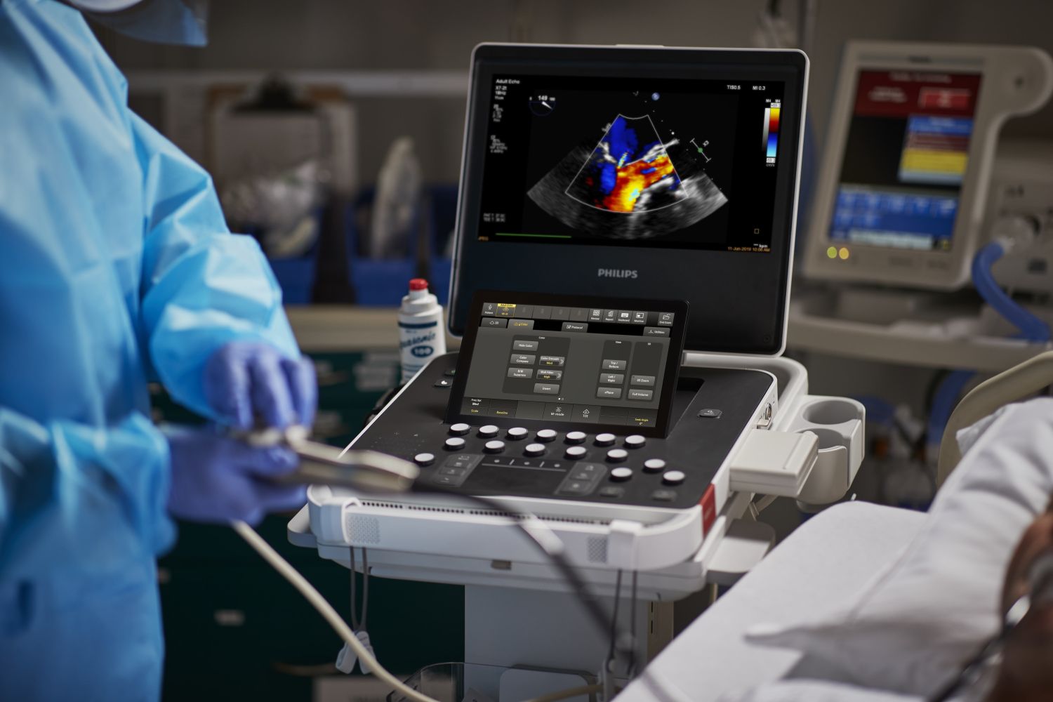 Philips presenta una IA para automatizar el análisis cardiaco