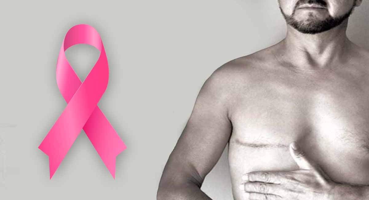Mito falso: el cáncer de mama solo afecta a las mujeres