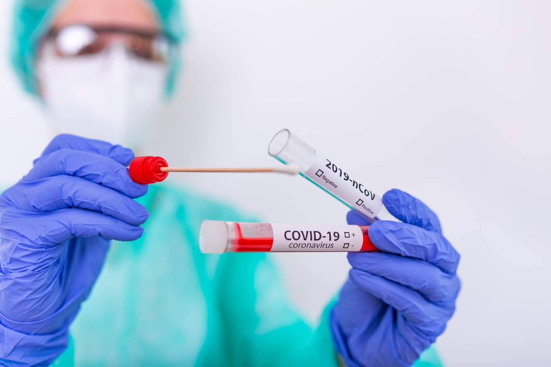 Centro Médico Bravo, test covid Madrid para estar tranquilo en las comidas y cenas con familiares