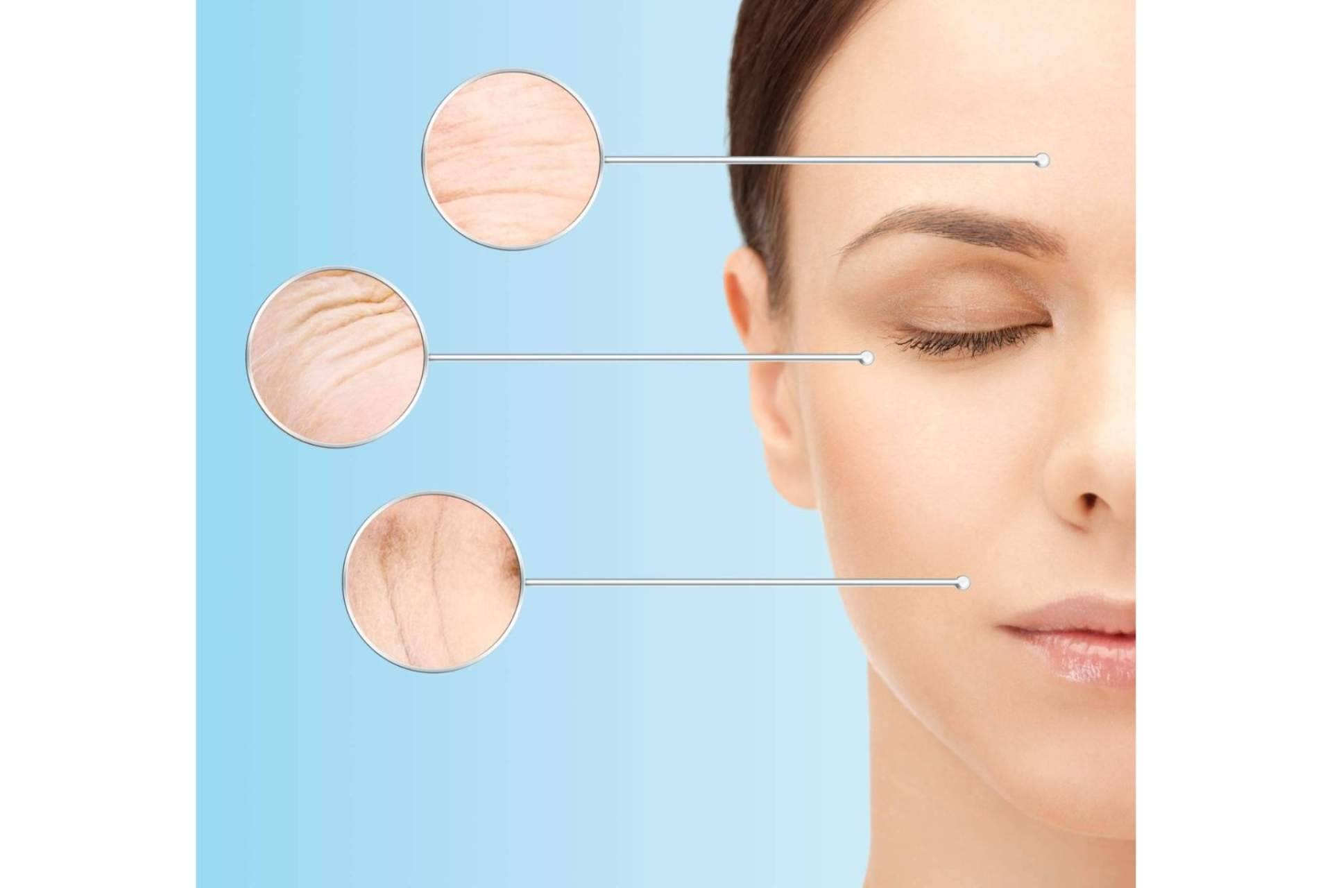 Las soluciones innovadoras para el cuidado de la piel a través de la mesoterapia facial de MesoINSTITUTE