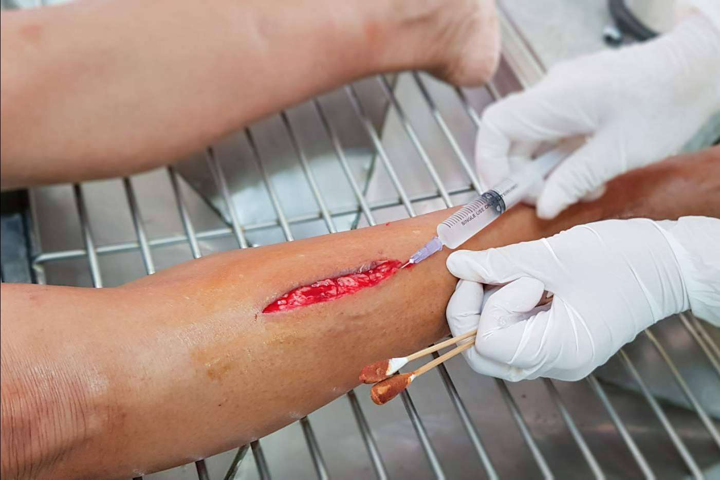 El próximo 6 de Febrero de 2023 Enfermería Evidente hará una formación gratuita sobre sutura online para profesionales sanitarios
