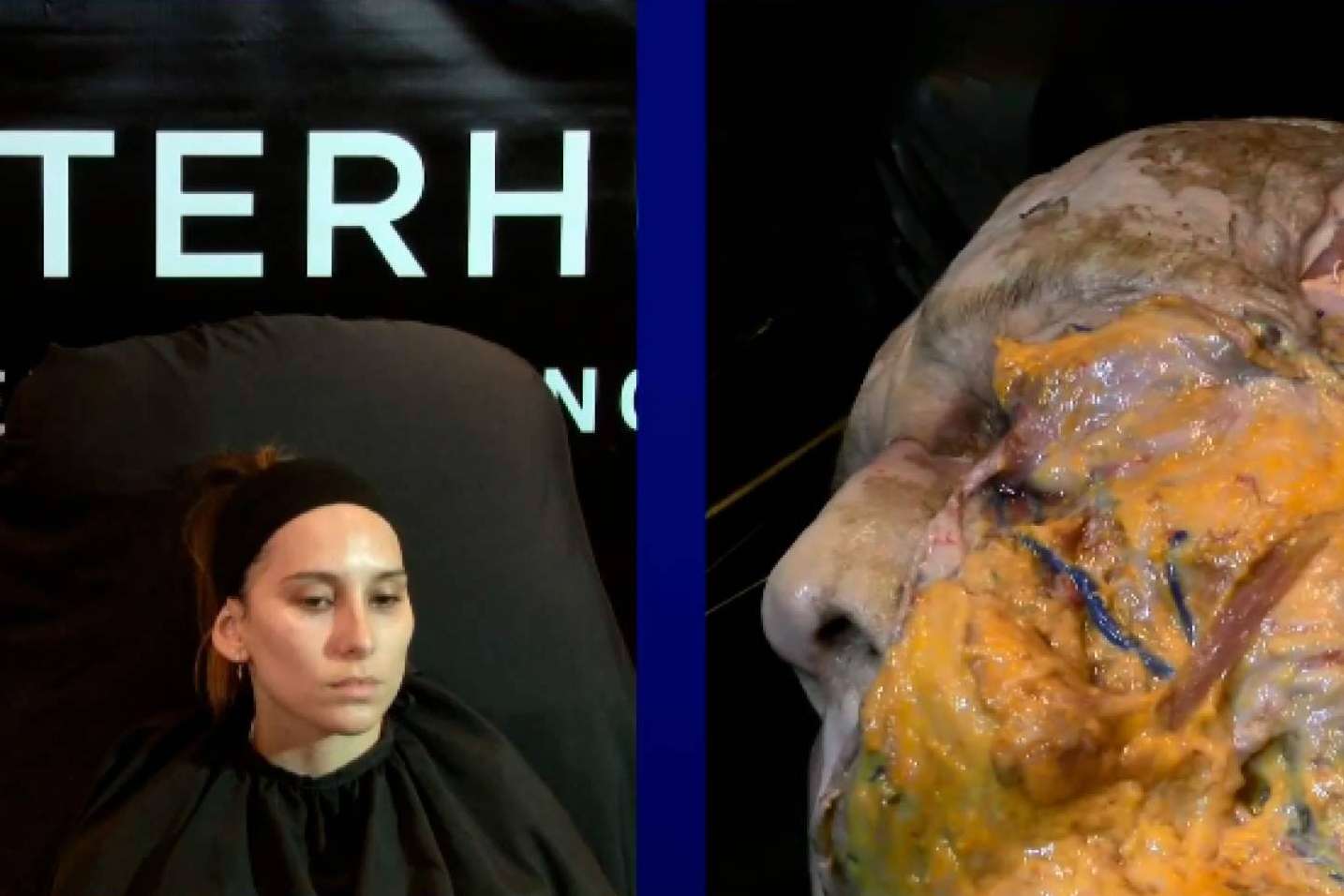 El congreso medicina estética Masterhub