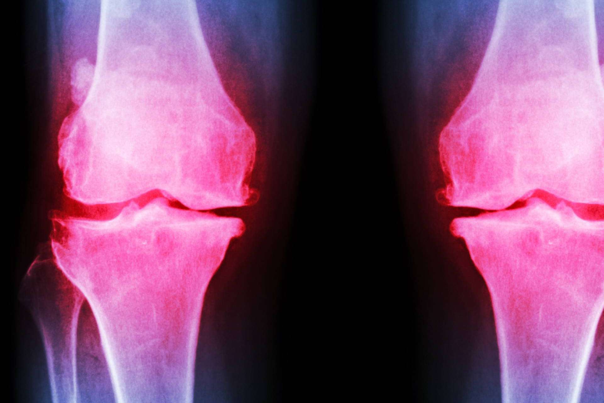 Muchas personas sufren dolor sin saber qué les sucede y en ocasiones es algo grave. La clínica de fisioterapia avanzada que ayuda a encontrar respuestas