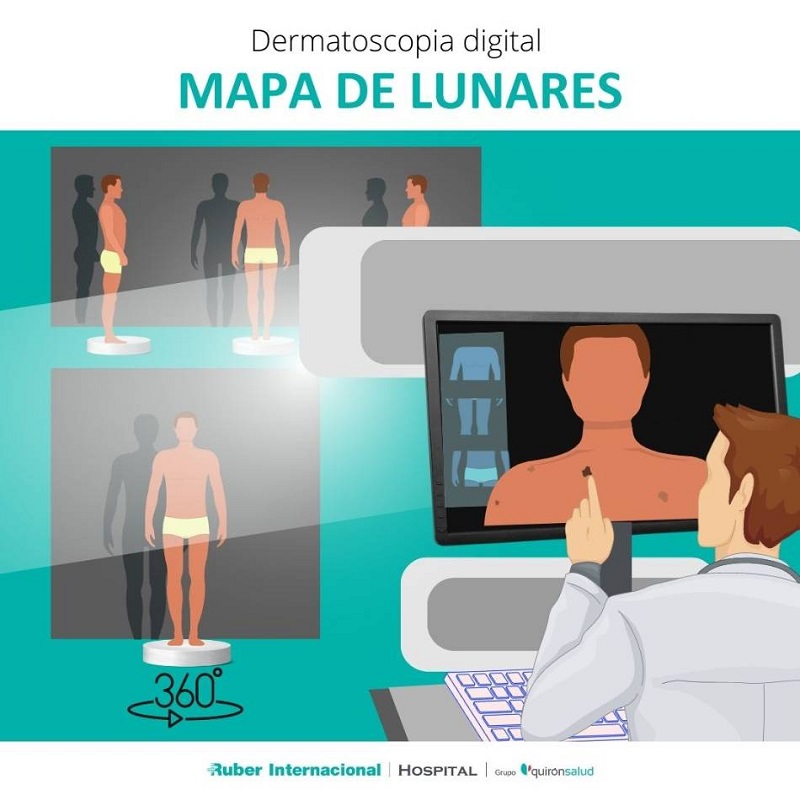 dermatoscopia Merca2.es