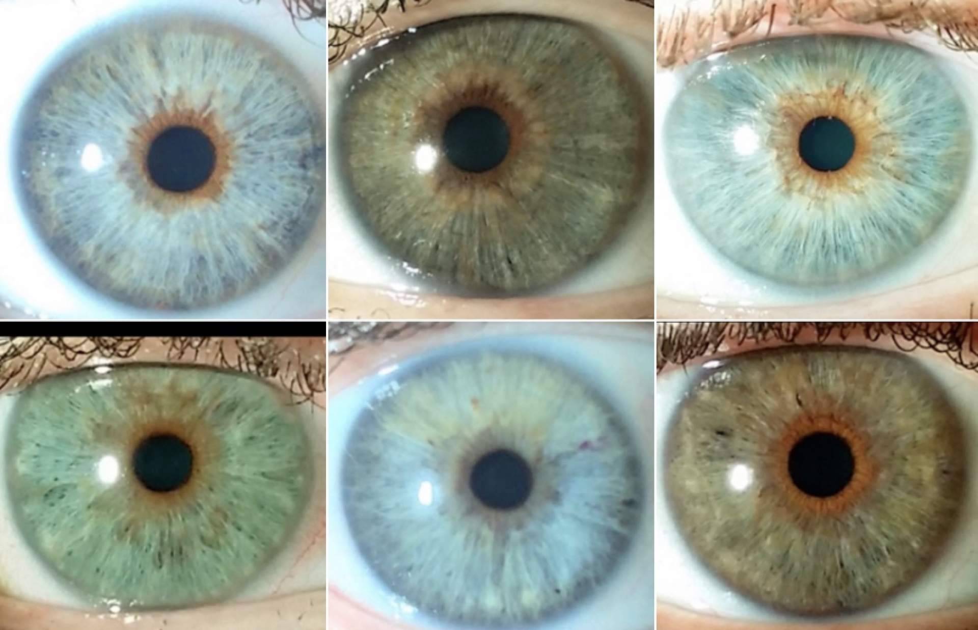 Seguridad en el cambio del color de los ojos, de la mano de Clínica Eyecos