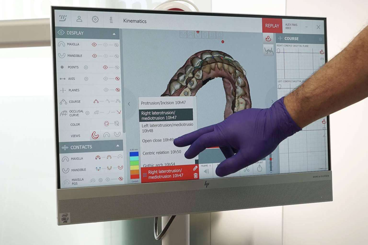Los tratamientos especializados de la Clínica Dental Darío Ulman