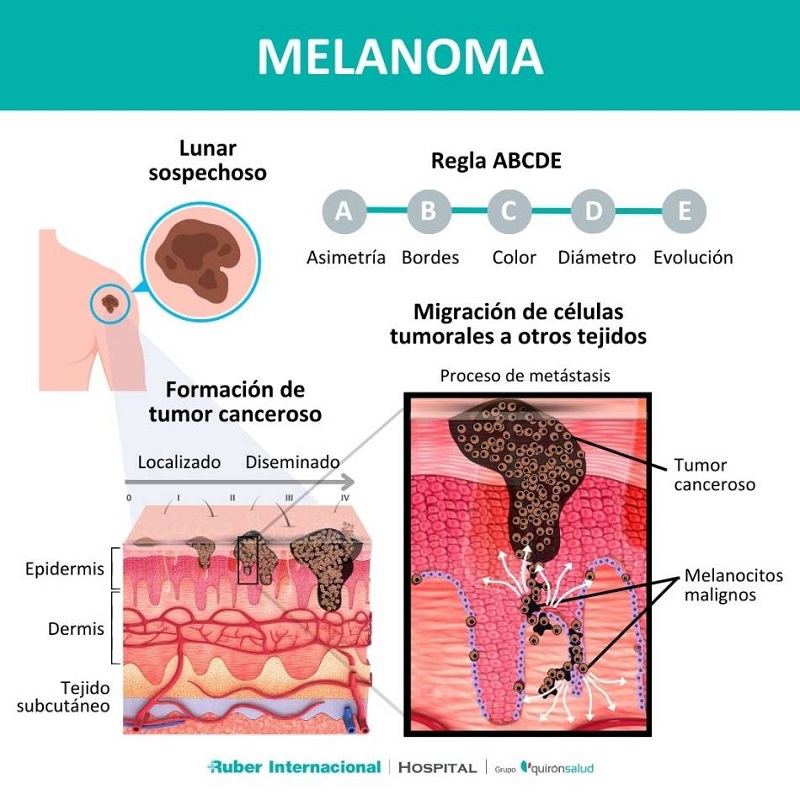 melan Merca2.es