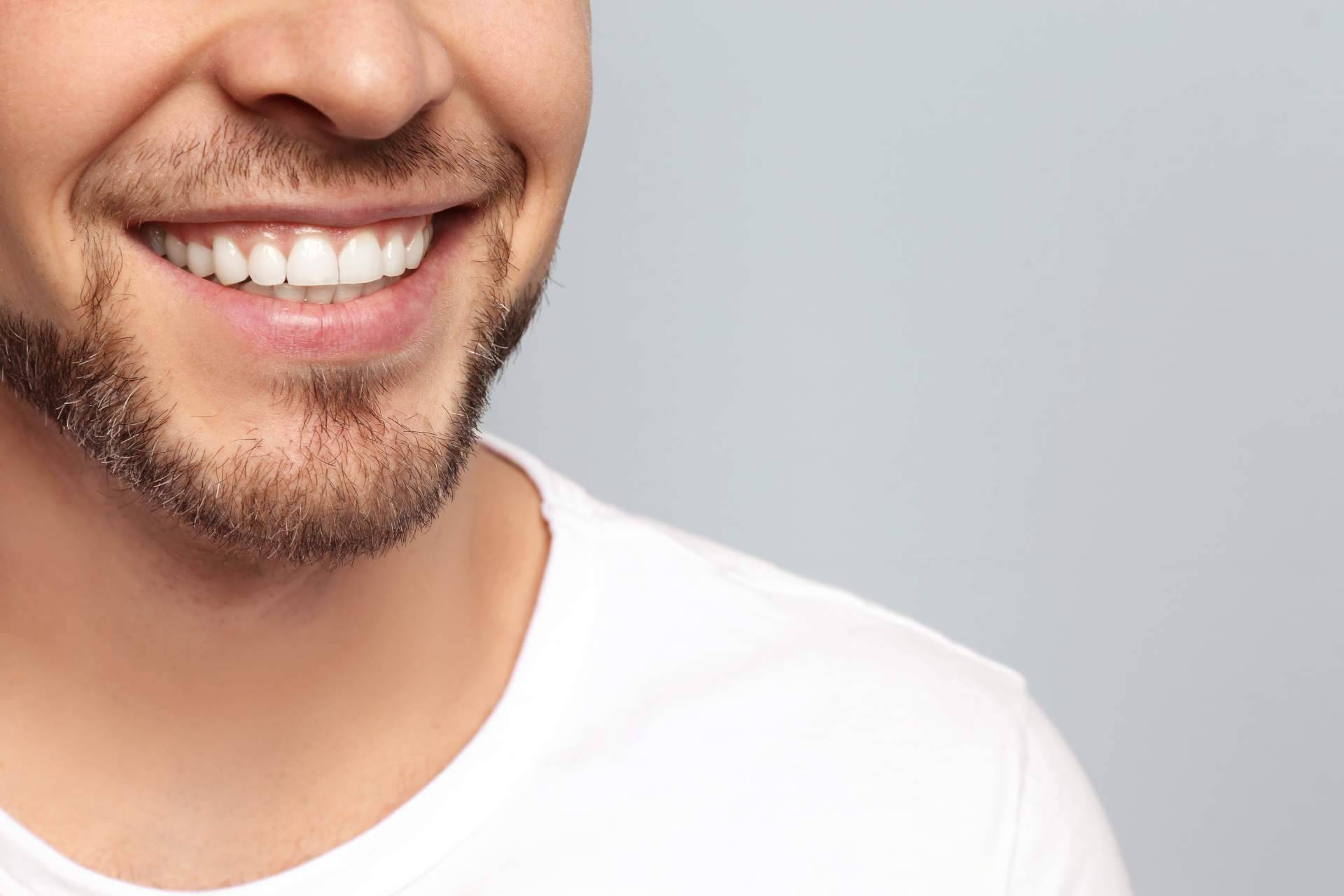 ¿De qué trata la cirugía de sonrisa gingival?