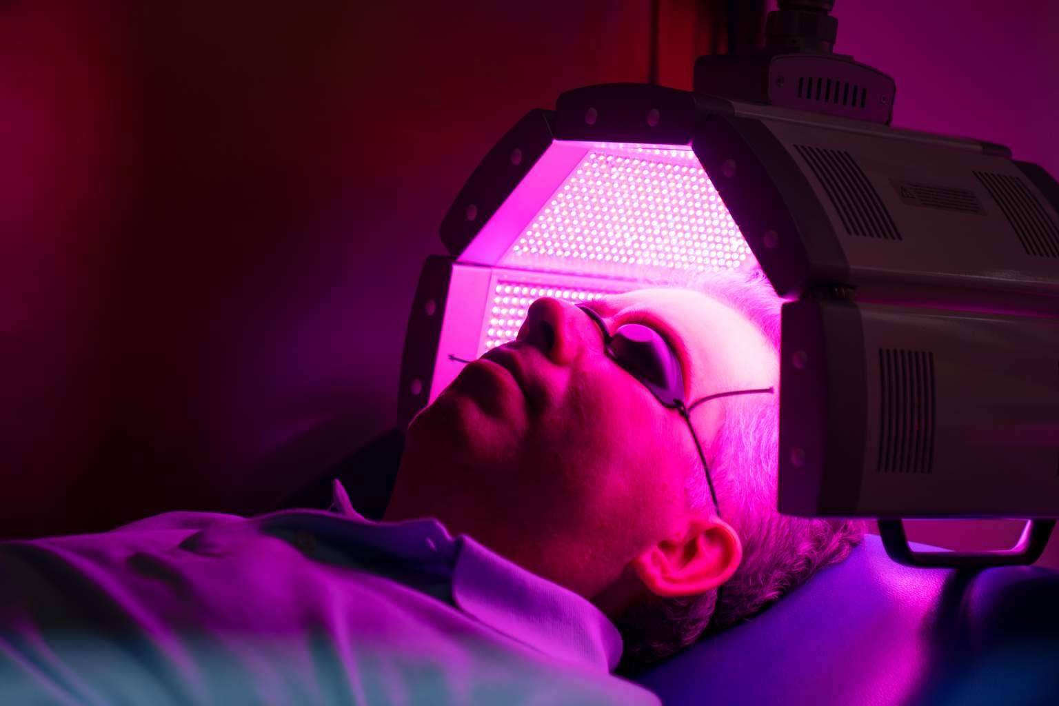 Innovadora fototerapia LED capilar; el tratamiento no invasivo para combatir la caída del cabello