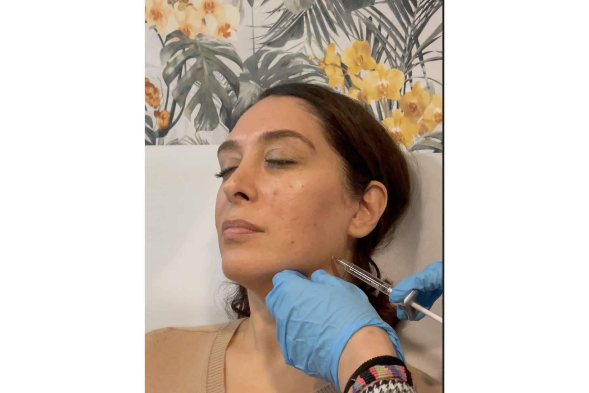 Dónde y por qué realizarse una marcación mandibular, de la mano de Cecilia Arthur