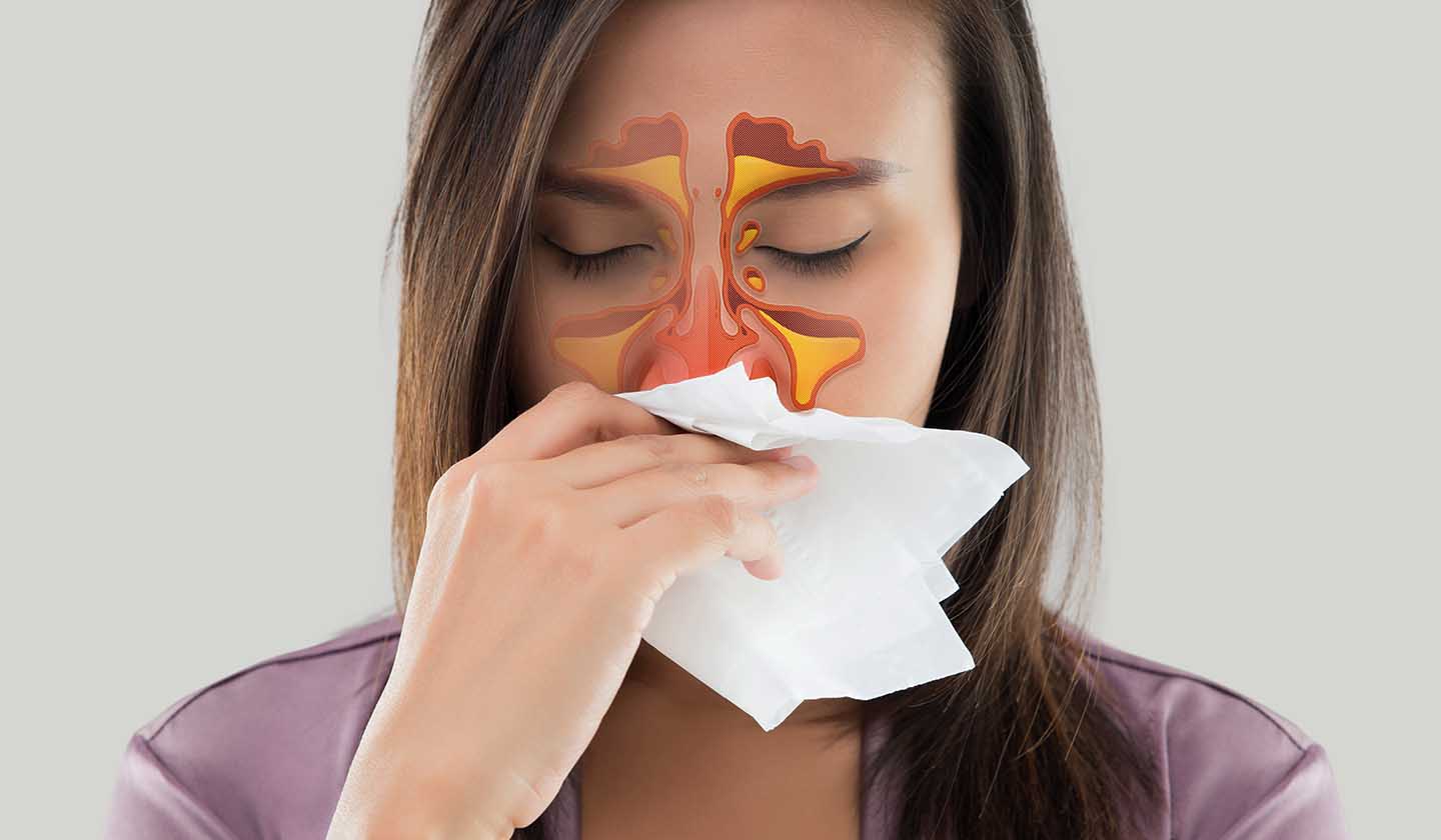 Cómo tratar la sinusitis y las alergias