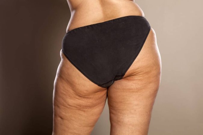Adecua tu dieta y estilo de vida