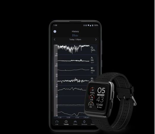 Joe Kiani, el empresario que acusa a Apple de plagiar sus smartwatch 1 Merca2.es Imagen de un smart watch de Masimo Merca2.es