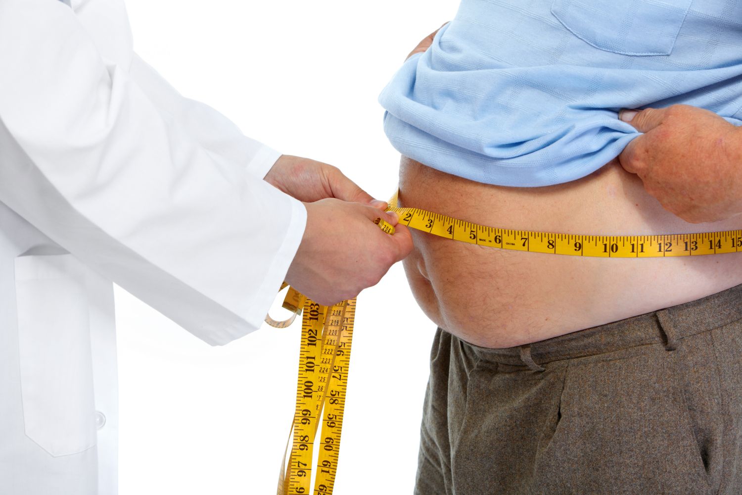 Obesidad: 8 alternativas naturales para mejorar tu calidad de vida