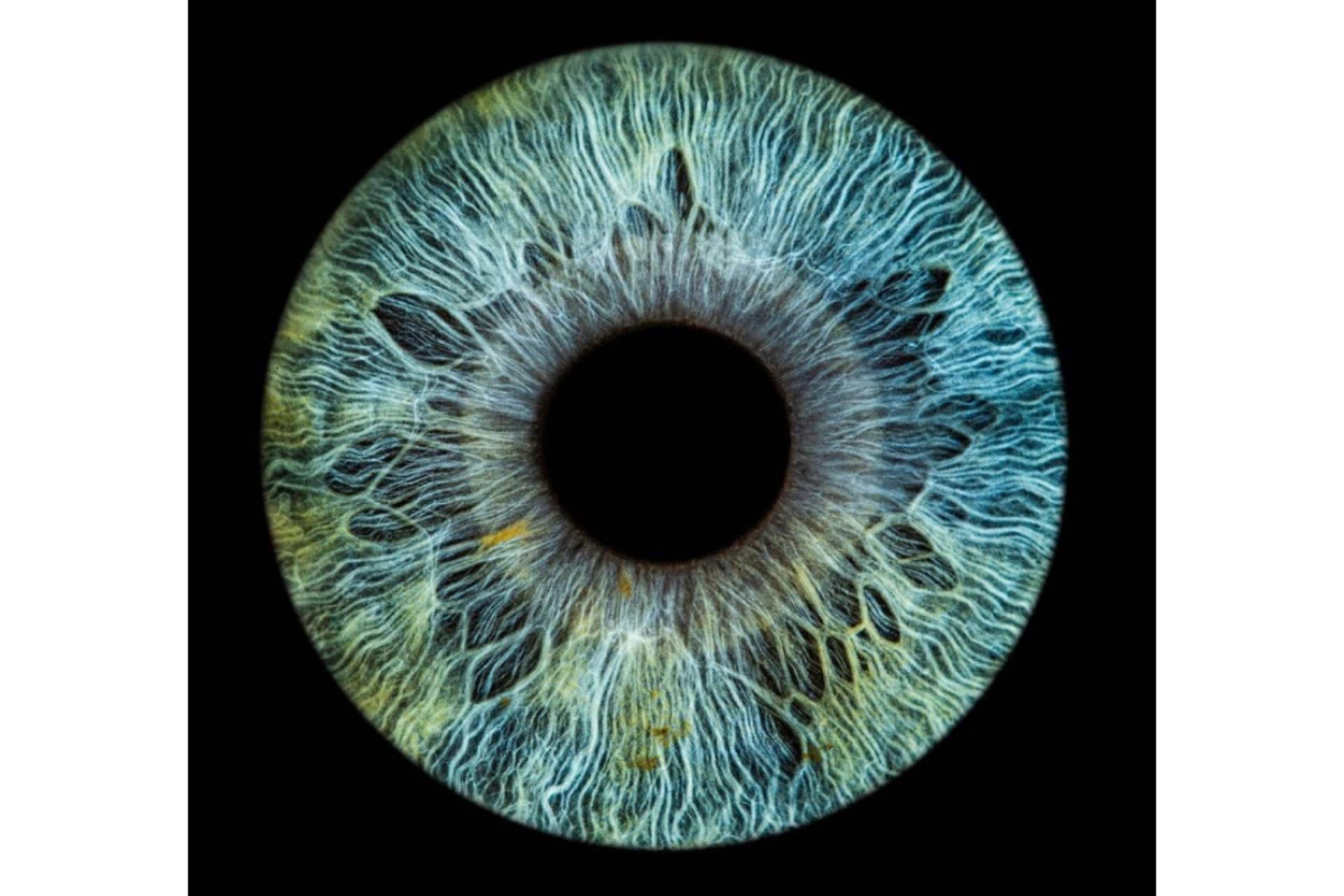 ¿Qué celebridades tienen una heterocromía ocular?, por Clínica Eyecos
