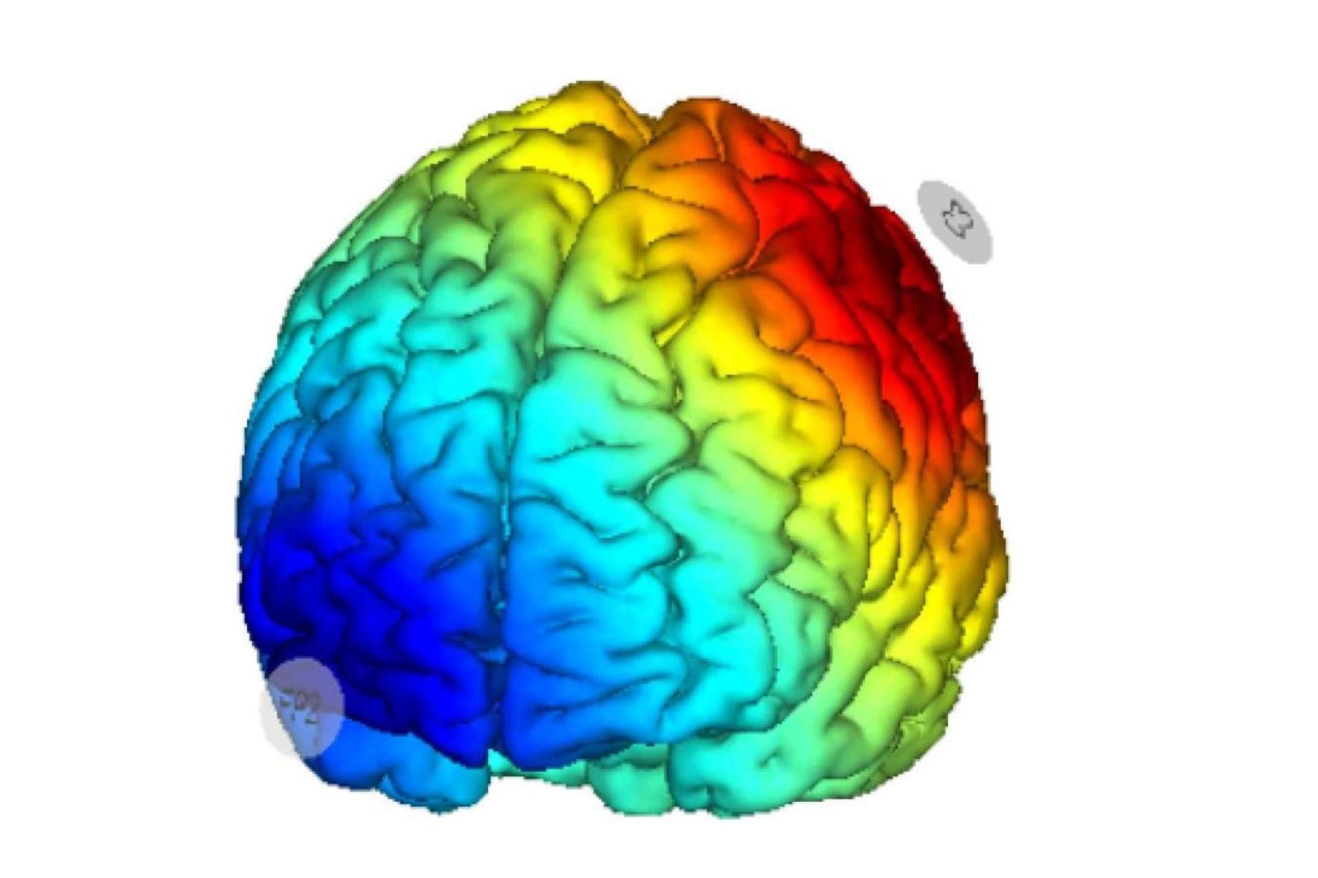 Tratamiento de la fibromialgia mediante estimulación cerebral no invasiva