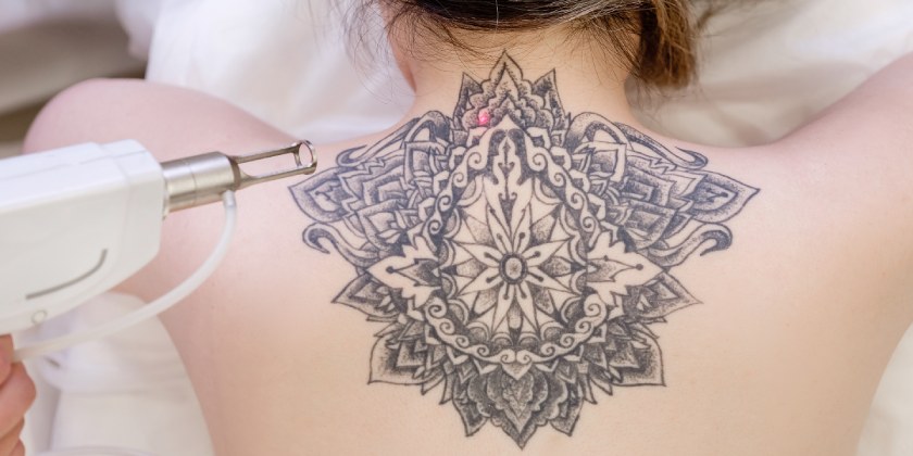 Los peligros de los tatuajes y de quitárselos