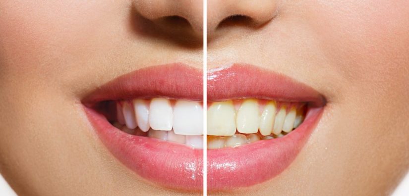 Alimentos que nos ayudan a tener los dientes más blancos