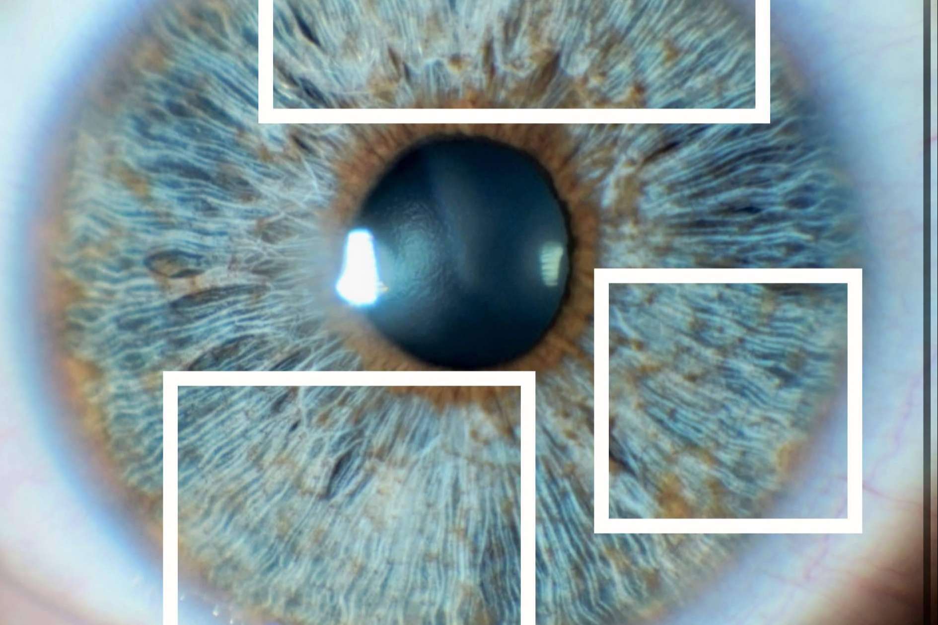 La importancia del colágeno del iris en el brillo de los ojos