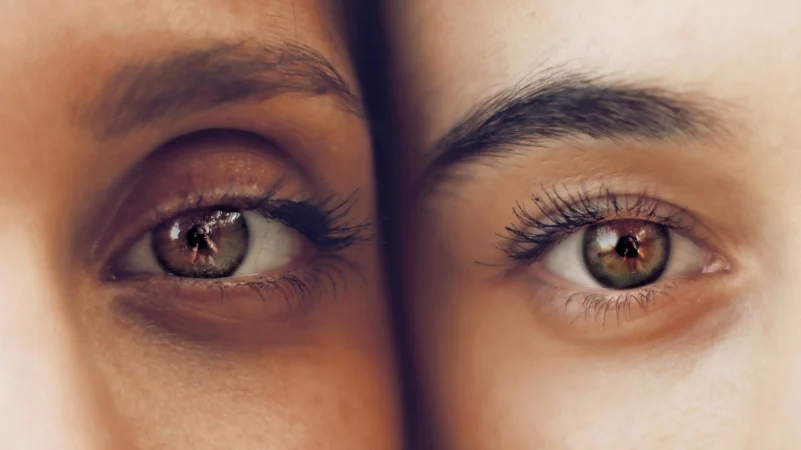 Las ojeras pueden tener múltiples causas