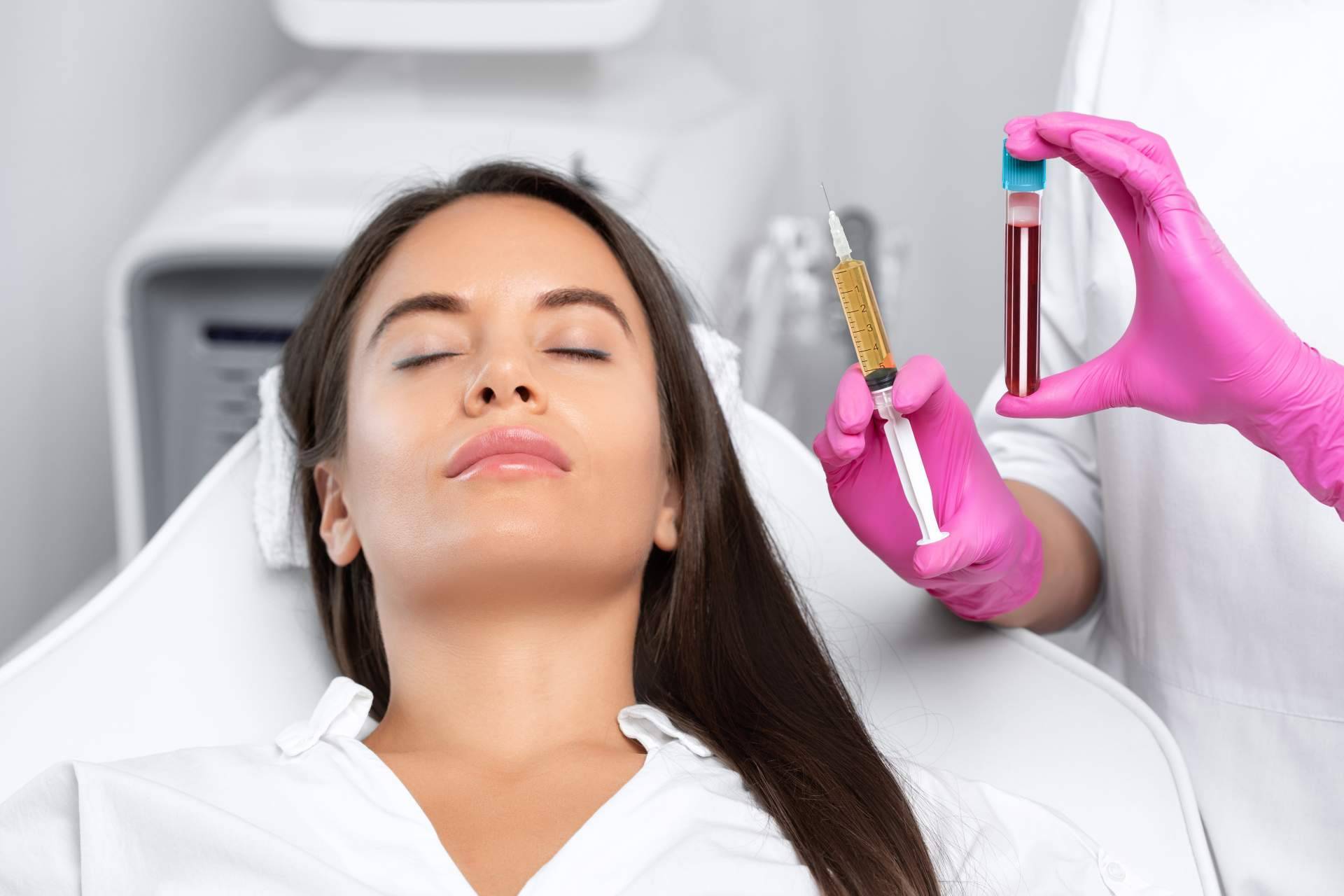 Aplicación de plasma rico en plaquetas facial de la mano del personal capacitado del Centro Médico El Pilar