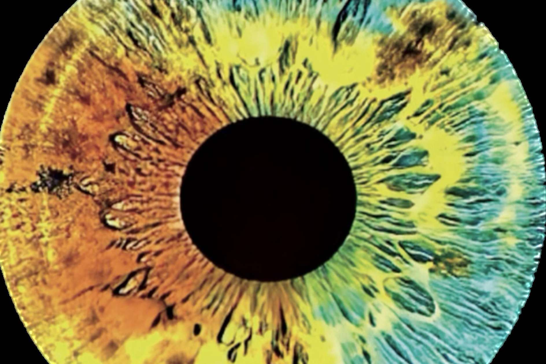 Investigación sobre los genes del color de ojos, por Clínica Eyecos