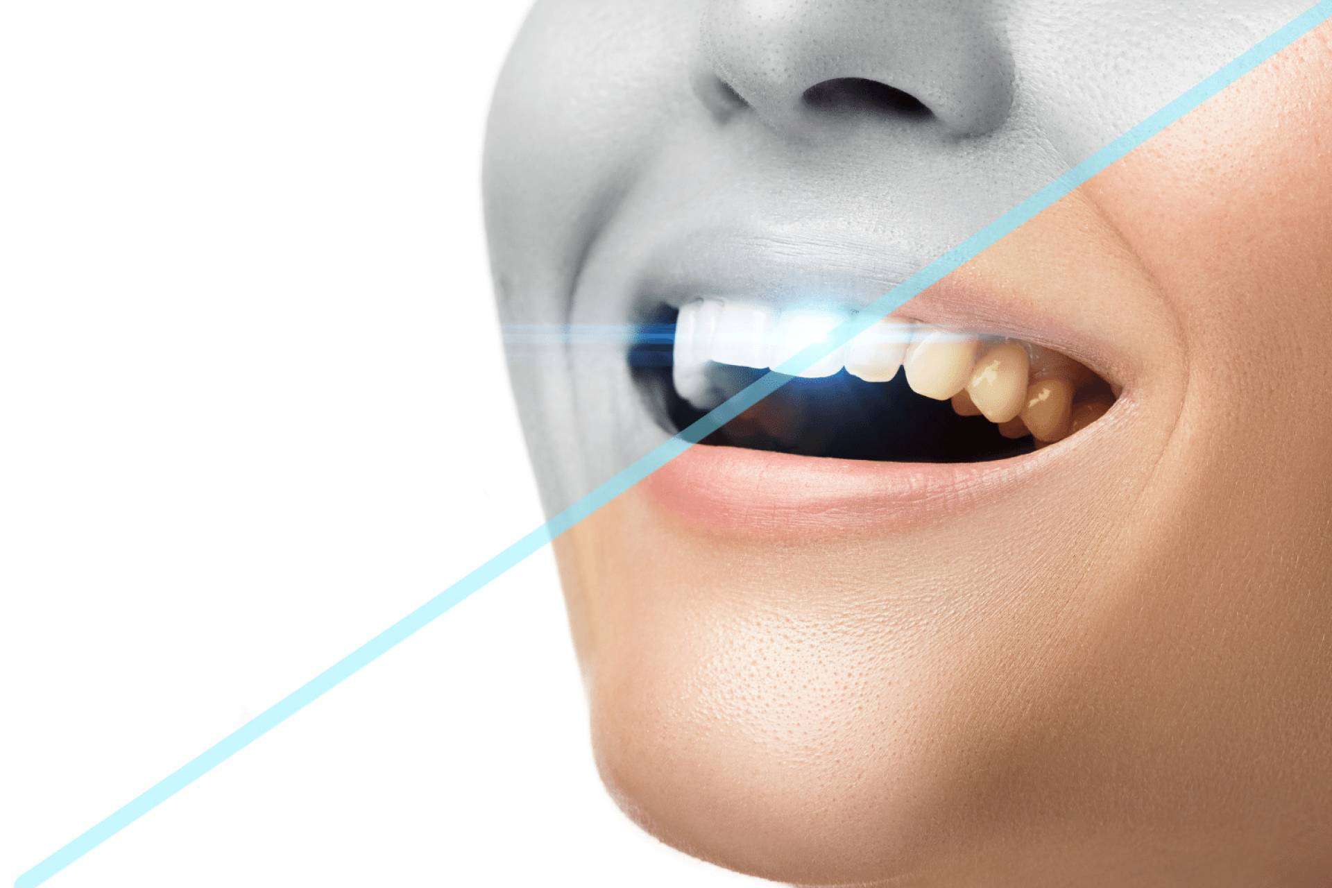 Ozonoterapia en odontología, una alternativa innovadora para la salud bucal