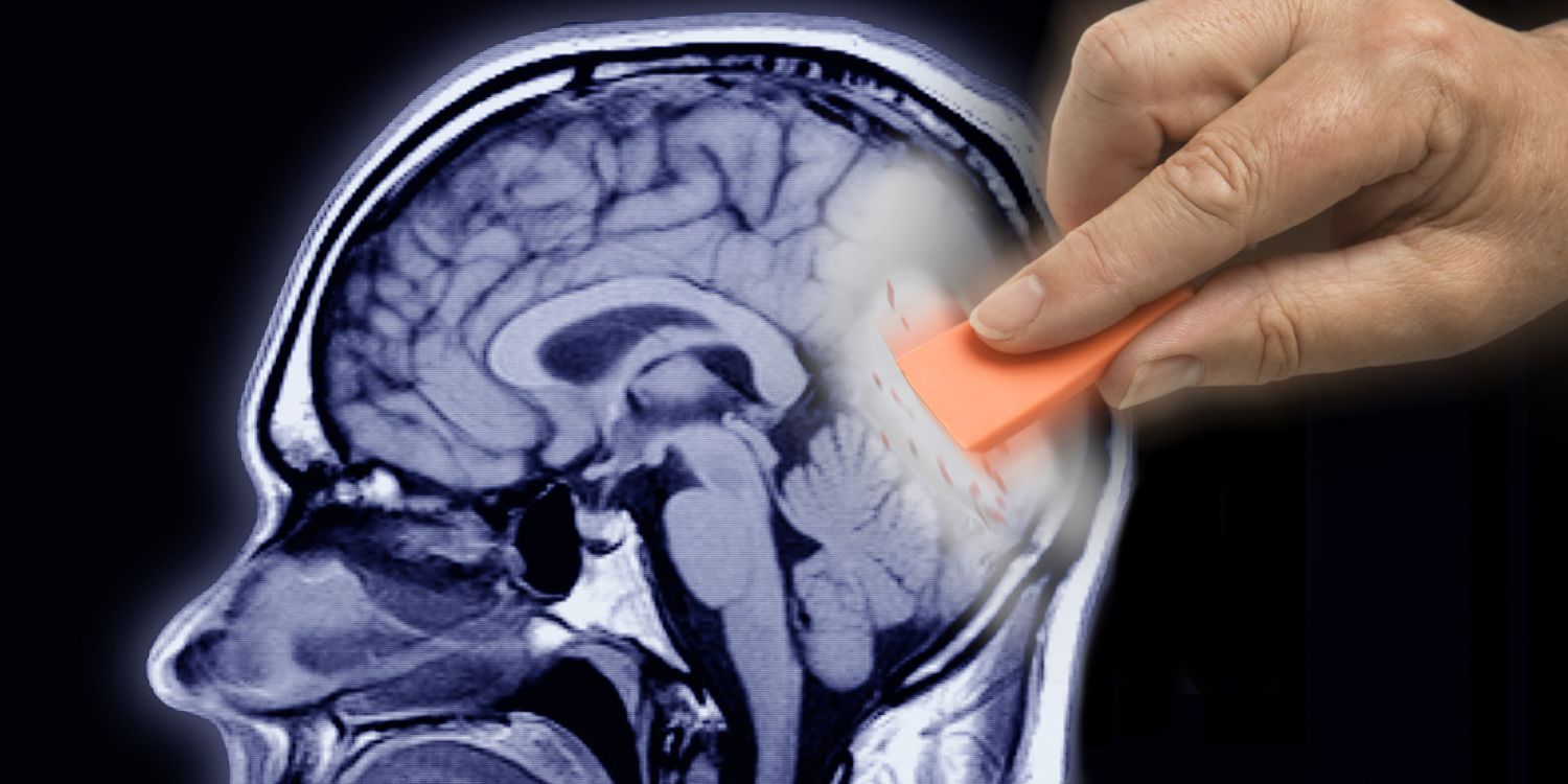 Alzheimer: cómo reconocer los primeros signos y retrasar su progreso